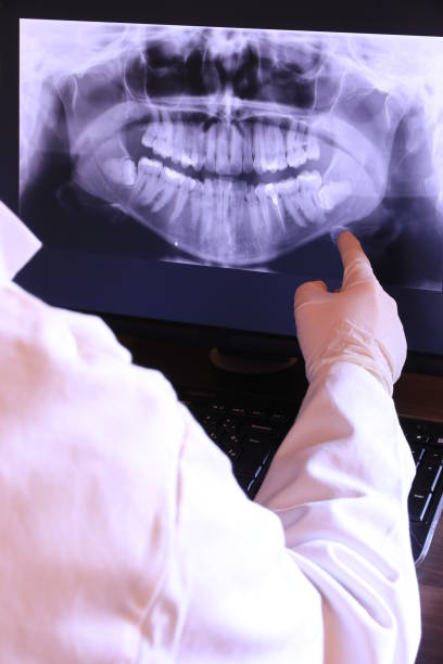 Best Broken or Cracked Tooth Emergency Dentist in Brookville, PA
