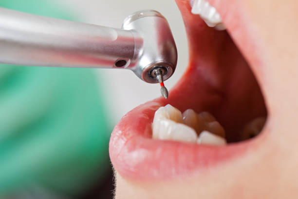 Best Emergency Dental Services for Seniors in Brookville, PA